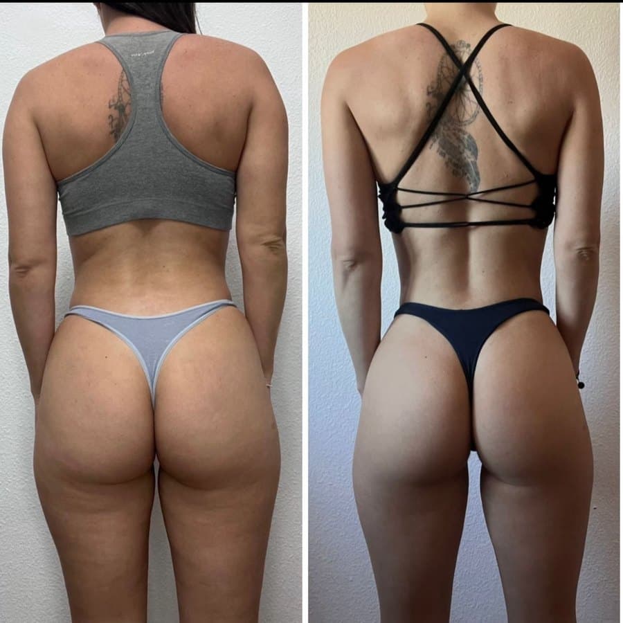 Physical transformation achieved with the Mutation Method (8 of 34)