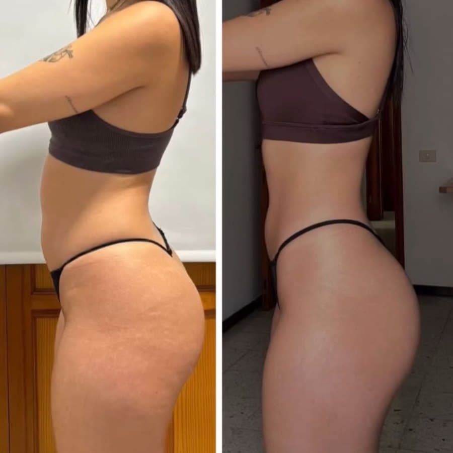 Physical transformation achieved with the Mutation Method (14 of 34)