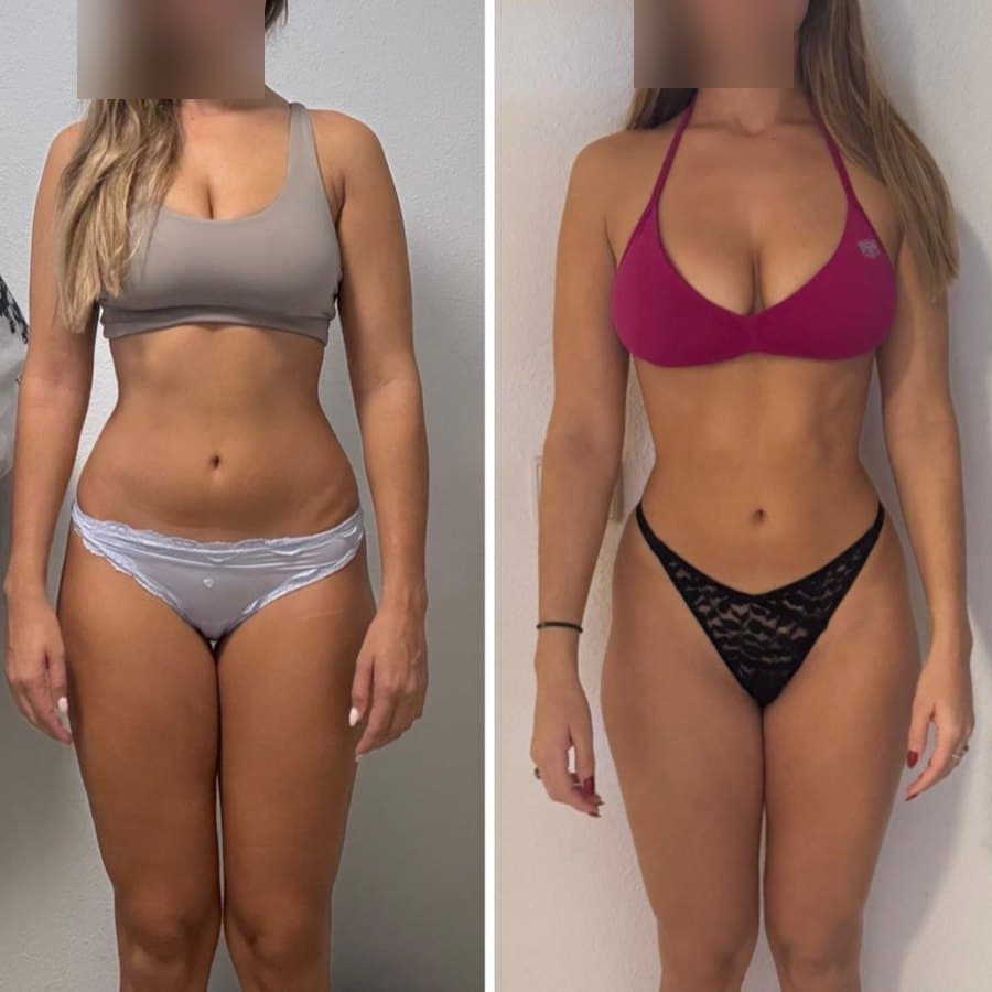 Physical transformation achieved with the Mutation Method (20 of 34)
