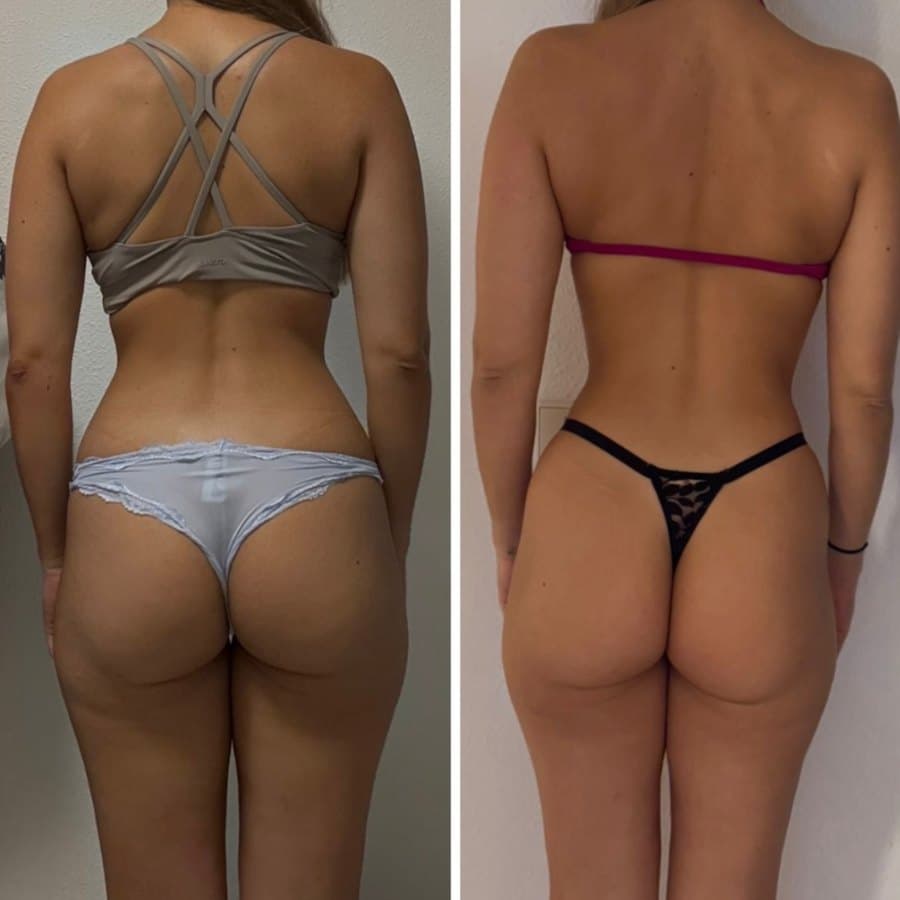 Physical transformation achieved with the Mutation Method (22 of 34)