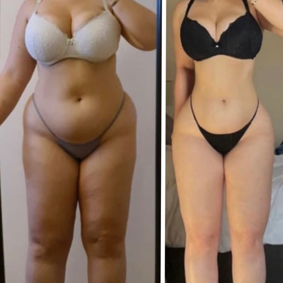 Physical transformation achieved with the Mutation Method (24 of 34)