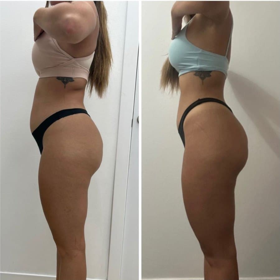 Physical transformation achieved with the Mutation Method (34 of 34)